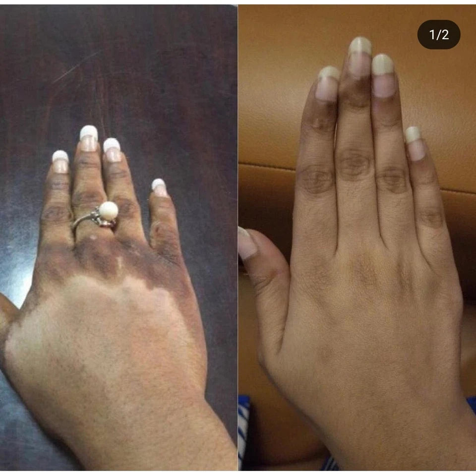 Byenblan Turmeric Face Cream 4 oz – Extra Strong Great Results