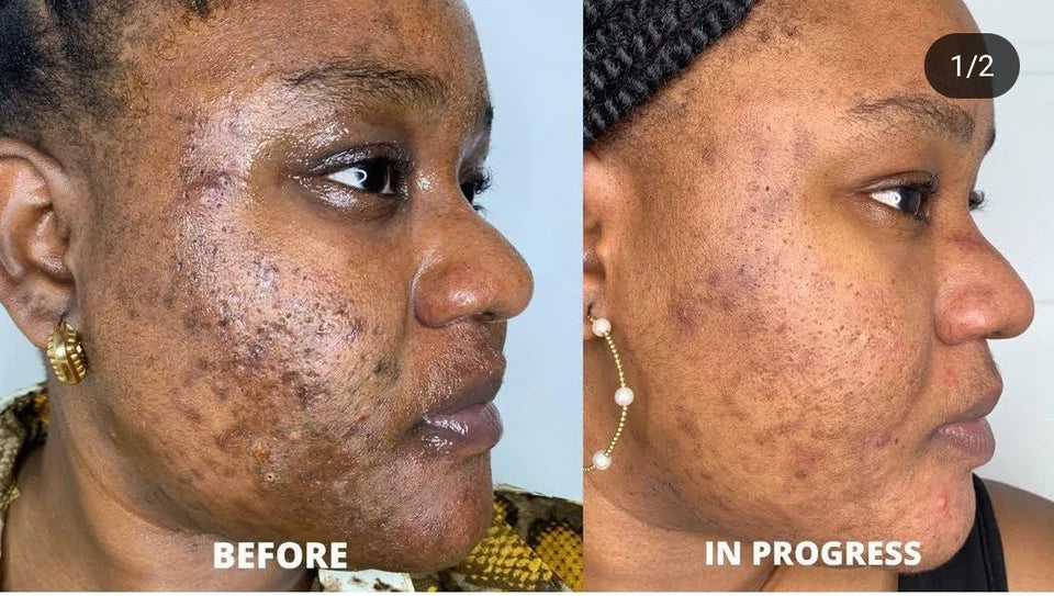 Byenblan Turmeric Face Cream 4 oz – Extra Strong Great Results