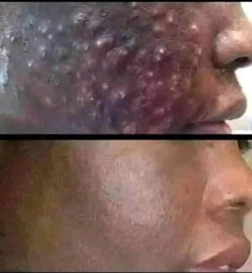 Byenblan Turmeric Face Cream 4 oz – Extra Strong Great Results